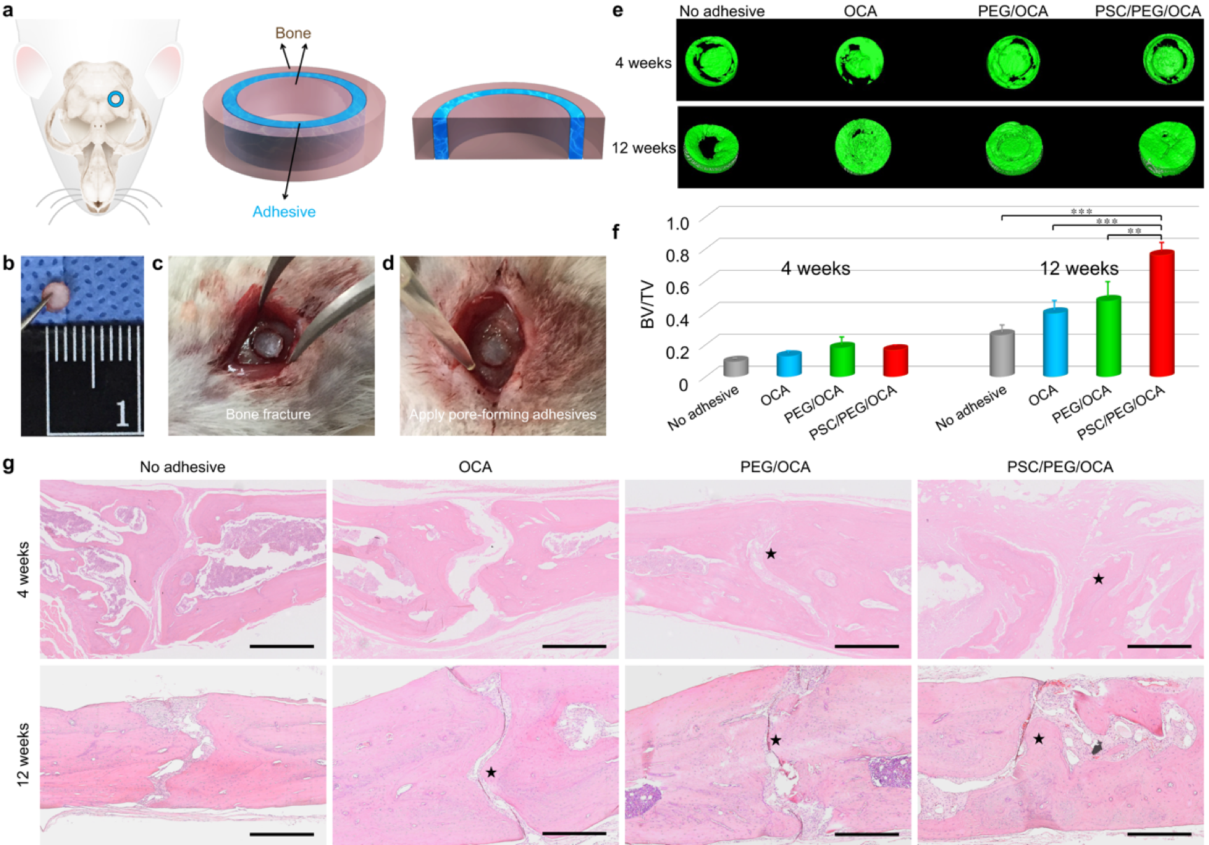 Bioactive pore-forming bone adhesives facilitating cell ingrowth for fracture healing